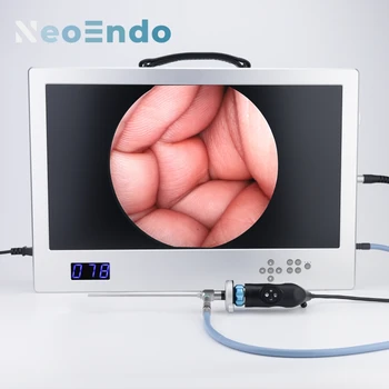 лапароскопия Медицинска Full HD ендоскопска камера система с 24-инчов монитор 80W LED източник на светлина и видеорекордер