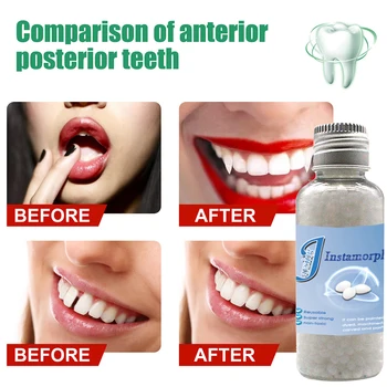 Teeth Gap Falseteeth Solid Glue Bottled Denture Dentist Temporary Tooth Repair